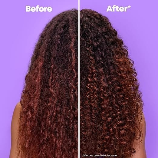 Before And After Matrix Mricale